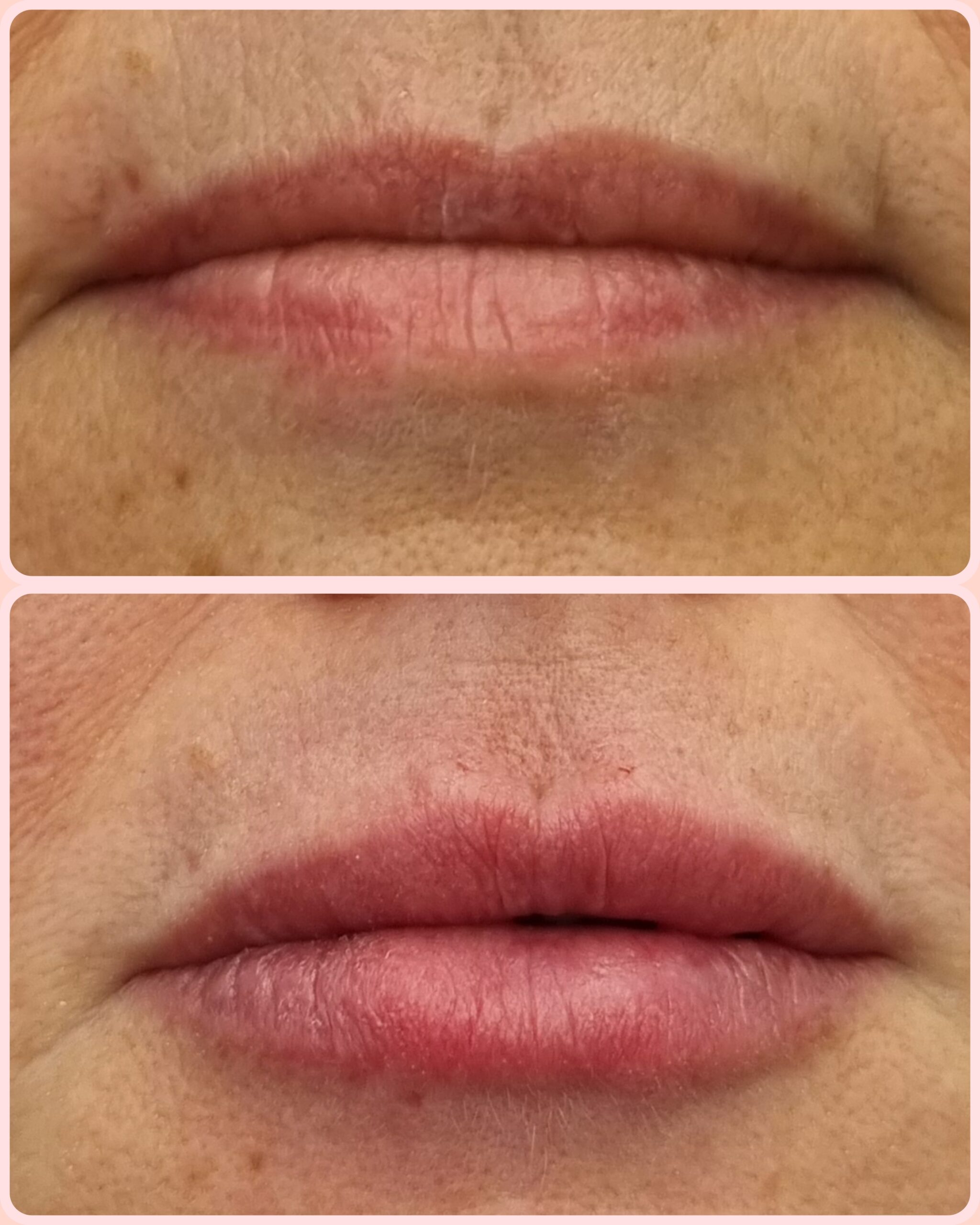 Resultado de tratamento 1