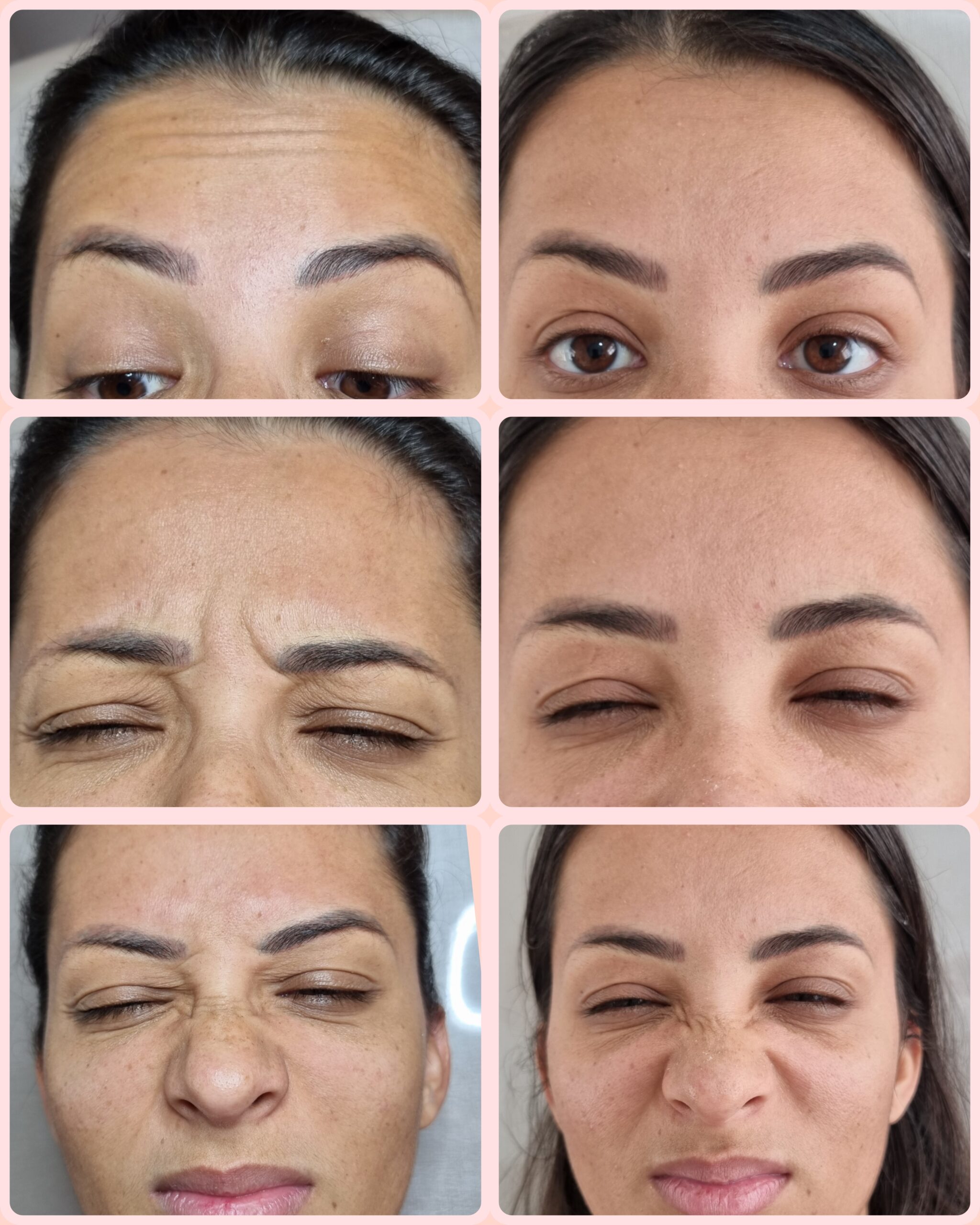 Resultado de tratamento 3