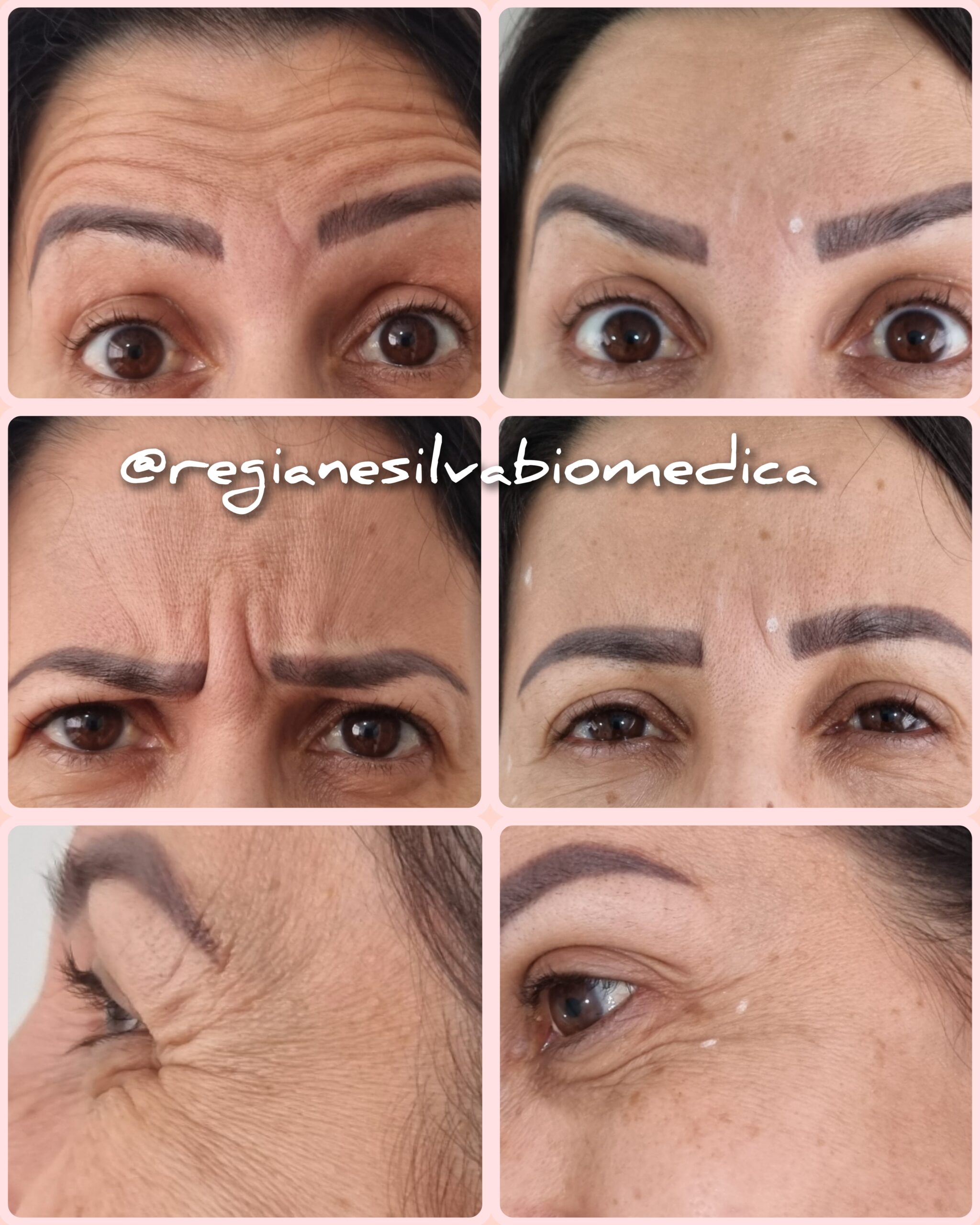 Resultado de tratamento 6